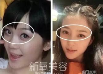 赵韩樱子整容前后:赵韩樱子是姓什么