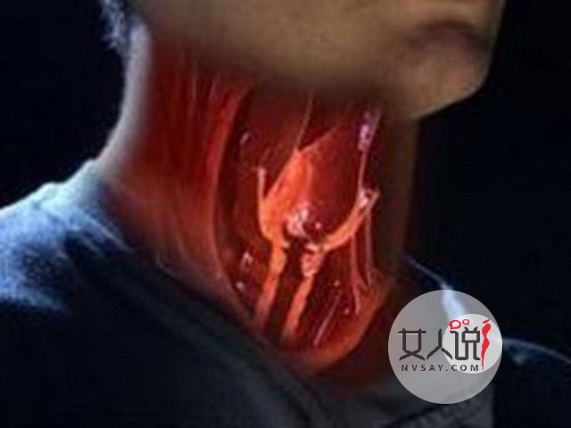 咽喉癌的早期症状,早知道早治疗.看看这里就知了